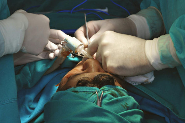 All types of Operations